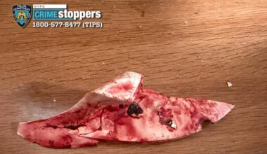 Understanding The Brooklyn Hospital Standoff With Police Response