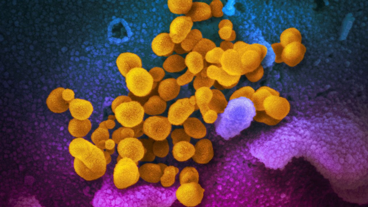 electron microscope image of long covid