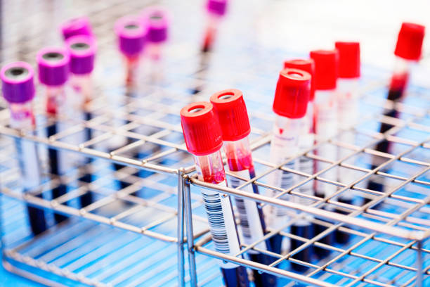 New York Blood Center declares blood emergency following deep drop in donations – QNS