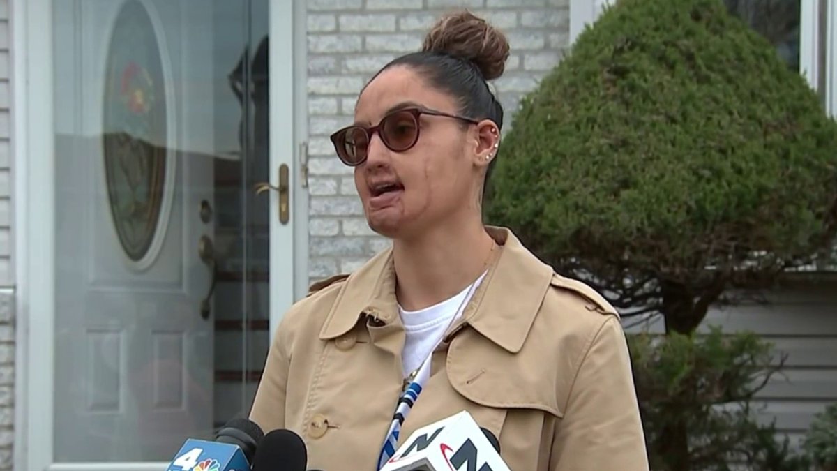 Arrest made in 2021 Long Island acid attack, sources said – NBC New York