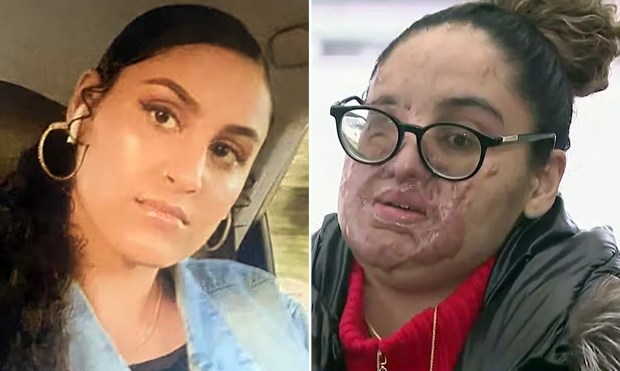 Nafiah Ikram is pictured before (left) and after the attack. (Obtained by NYDN; CBS New York)