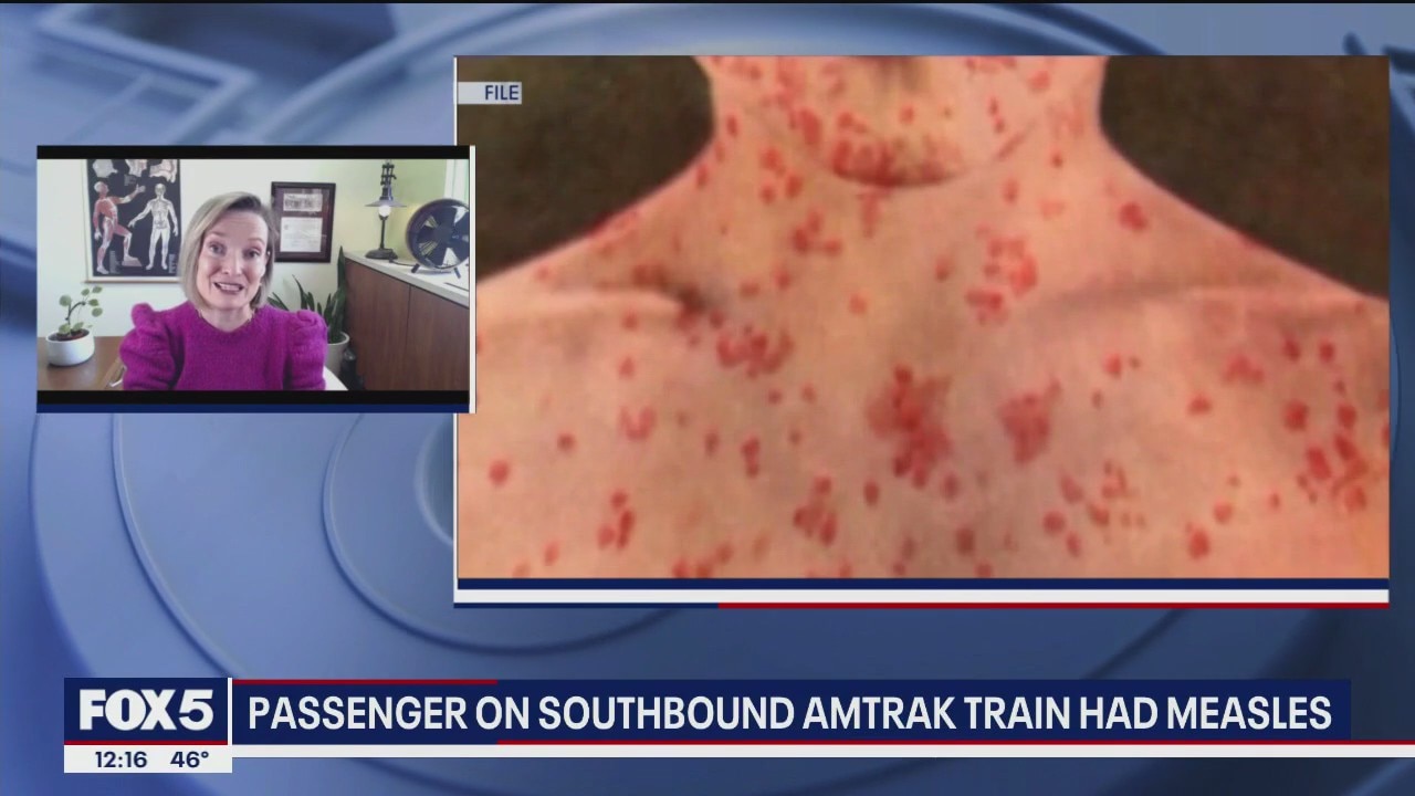 Health expert explains severity of measles outbreak on Amtrak train