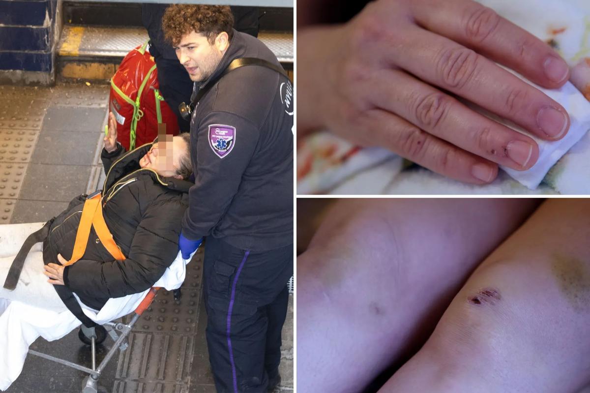 Woman shoved onto NYC subway tracks by crazed attacker slams Mamdani's safety plan