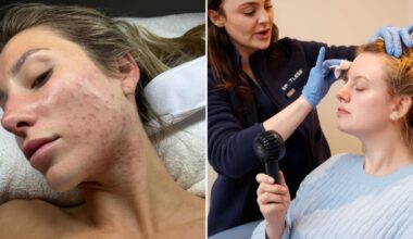 NYC's CityMD for quick-fix, on-your-lunch-break acne treatments