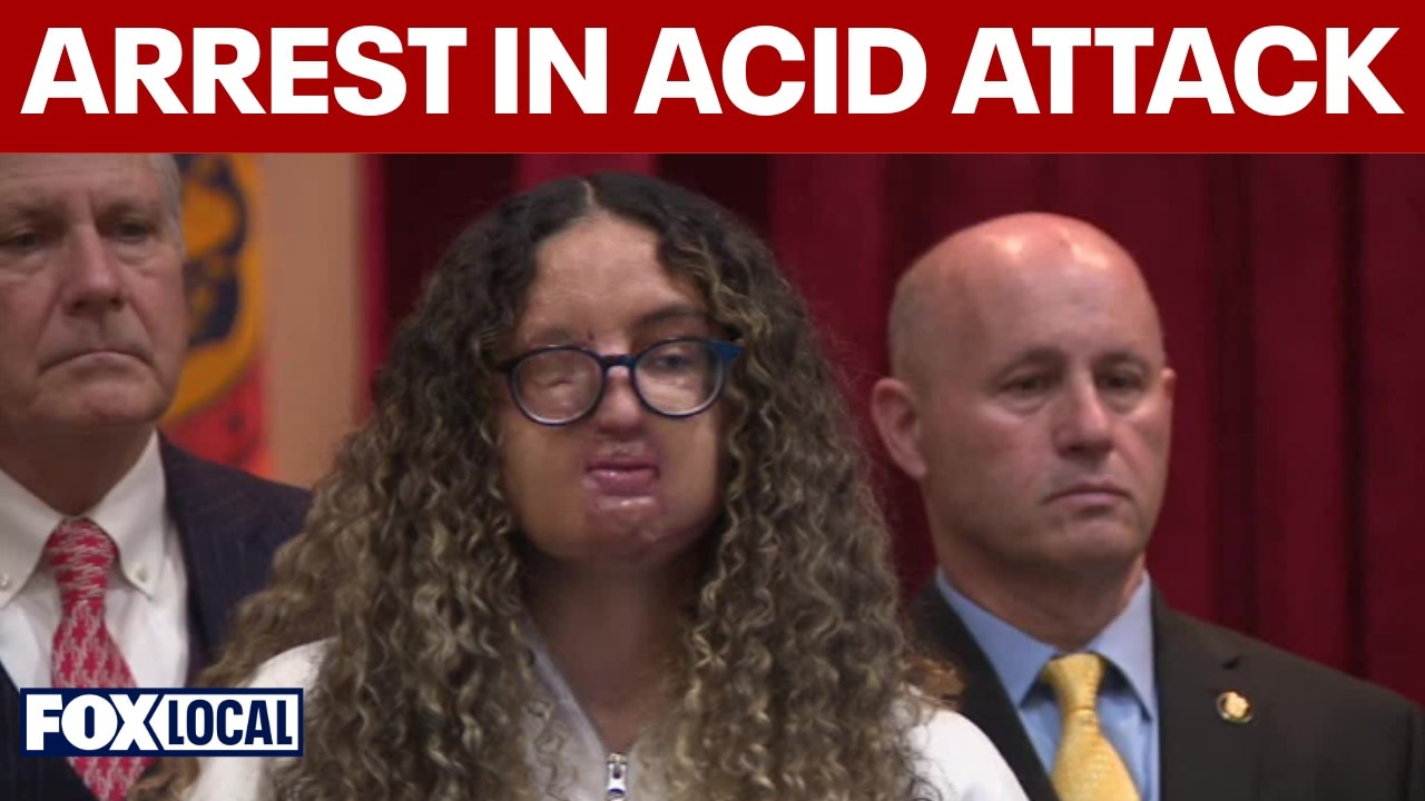 Arrest made nearly 5 years after Long Island acid attack