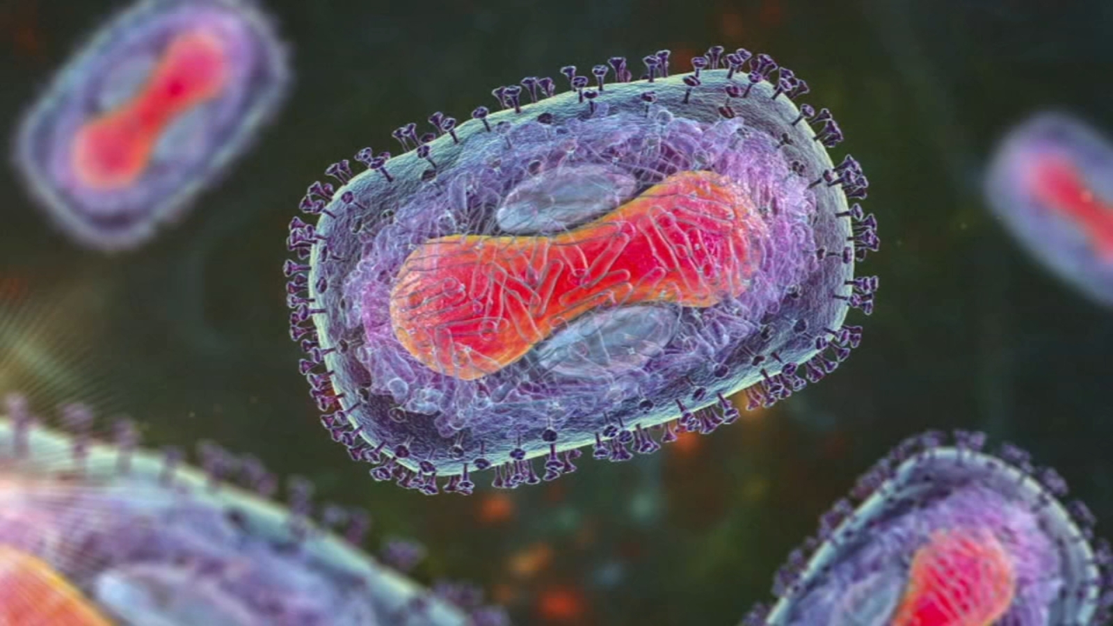 First known case of severe Mpox strain discovered in New York City