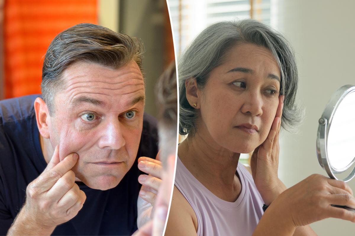 The reason for sagging jowls and what to do about it