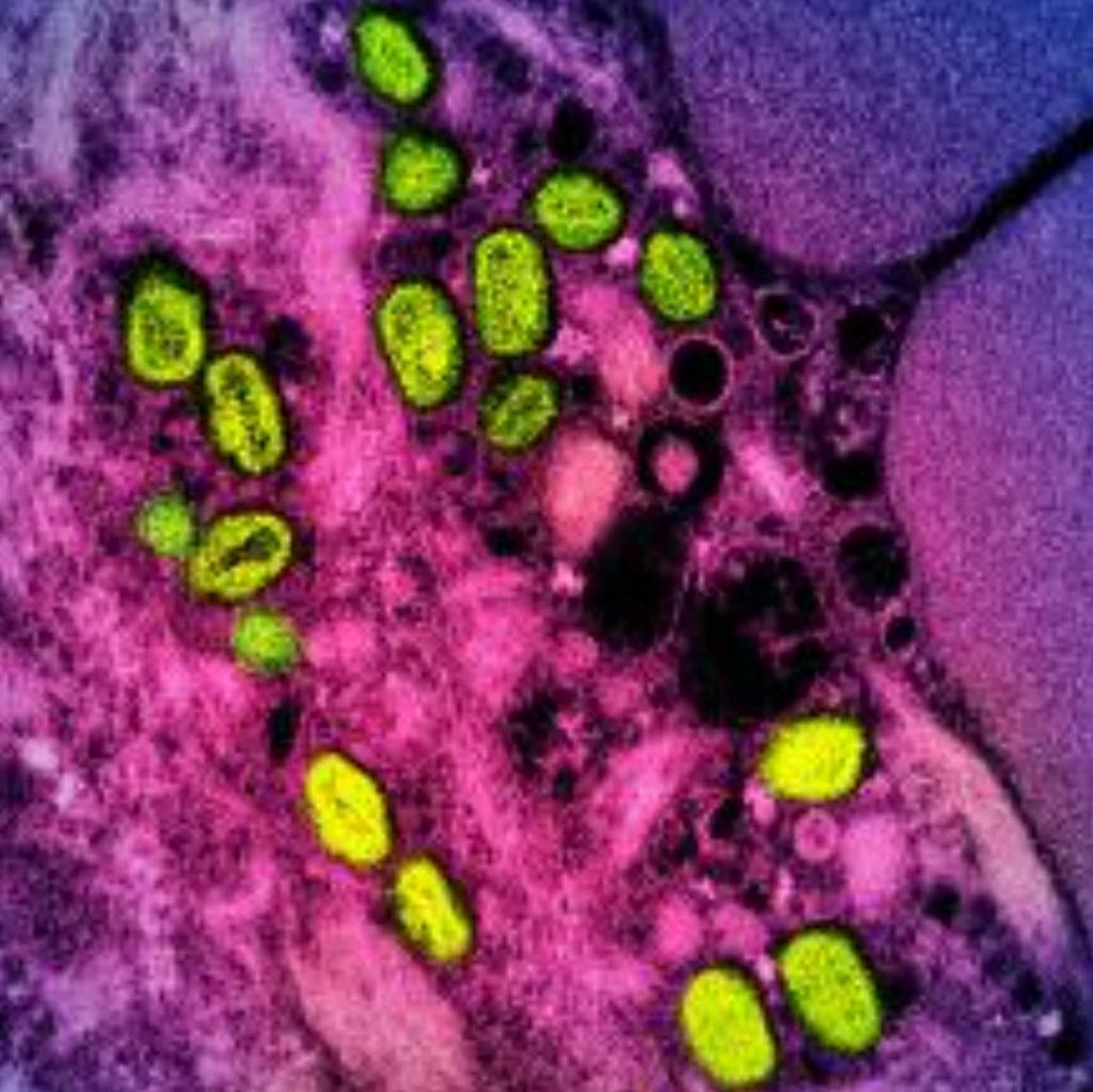 Colorized transmission electron micrograph of green monkeypox particles within a pink and purple infected cell.