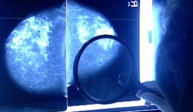 Discussing environmental factors in breast cancer causation