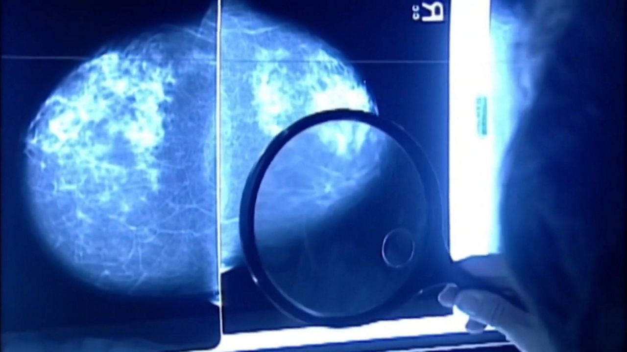 Discussing environmental factors in breast cancer causation