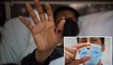 First known case of severe mpox virus strain detected in NYC