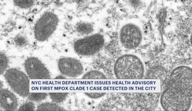 News 12 | Brooklyn | Severe mpox strain detected in NYC