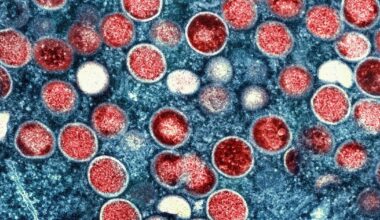 More serious mpox strain detected in NYC for first time