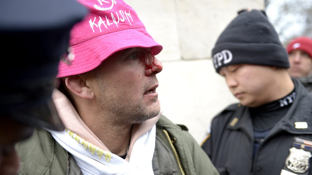 Jewish rapper Rami Even-Esh, known as "Kosha Dillz," ends up bloodied after an altercation with supporters of the late Ayatollah Ali Khamenei at Washington Square Park on March 6, 2026.