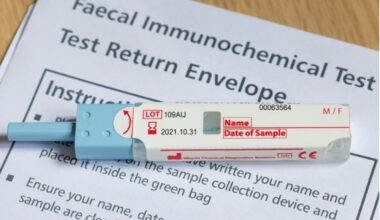 NYC Health + Hospitals Surpassed 70% Colorectal Cancer Screening Rate Among Eligible Patients for the First Time