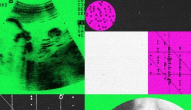 Designer Baby Companies Are in Turmoil
