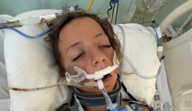 Teen recovering after electric skateboard crash in western Palm Beach County