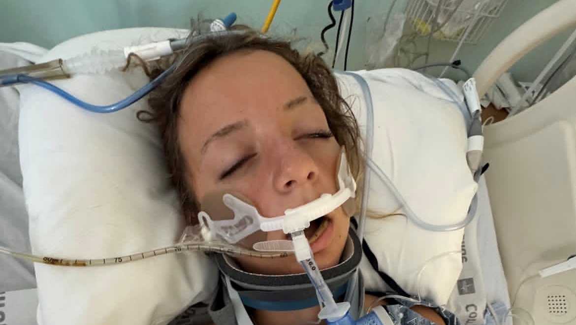 Teen recovering after electric skateboard crash in western Palm Beach County