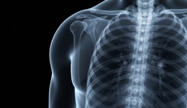 A ghostly, translucent X-ray image of a human chest, with the ribs and internal structures glowing faintly against a dark background, conceptually representing the automation of medical diagnosis using artificial intelligence.