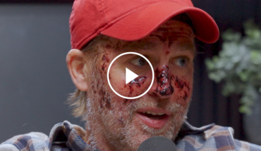 Opinion | What Dying Feels Like