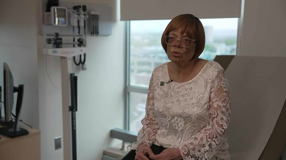 Two-time heart transplant recipient looks to save lives – NBC New York