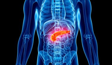 Two Drugs Stir Hope for Treatment of Deadly Pancreatic Cancer