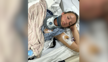 Teen has to 'speak again, walk again' after electric skateboard crash