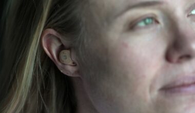 NYC Ballet dancer shares her experience with hearing loss