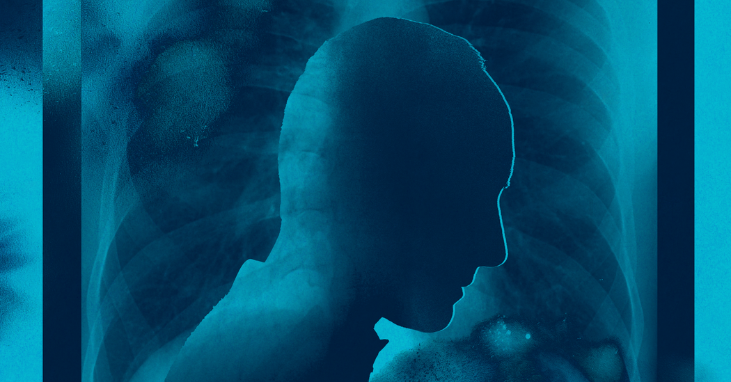 About Half of Patients with Metastatic Lung Cancer Don’t Get Treatment, Study Finds