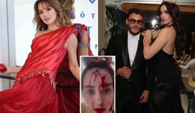 Blood-covered Venezuelan beauty queen attacked by stylist at Cannes