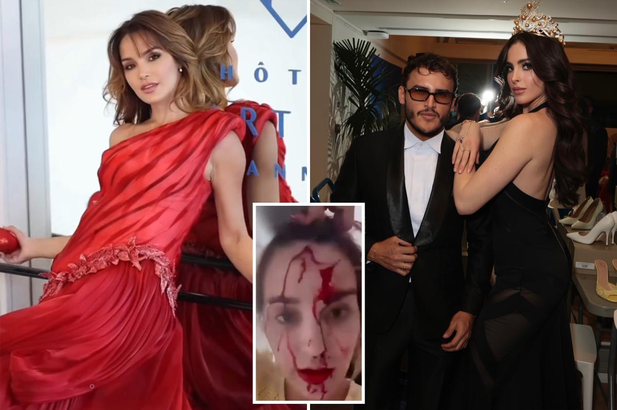 Blood-covered Venezuelan beauty queen attacked by stylist at Cannes