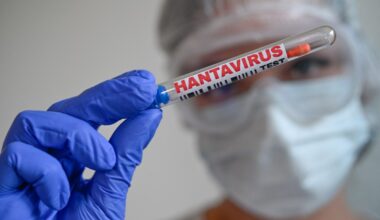 High School Student May Be Infected With Hantavirus in New York
