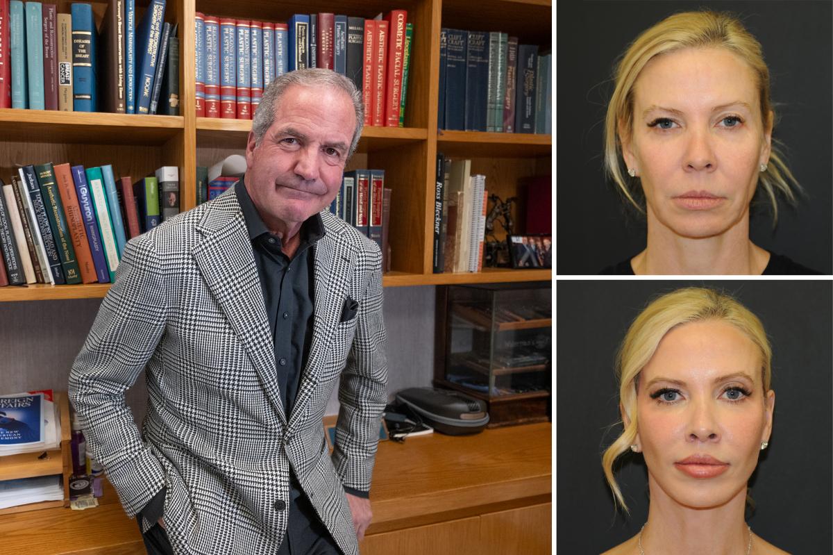 NYC plastic surgeon operated on his entire family — and gave sister a boob job