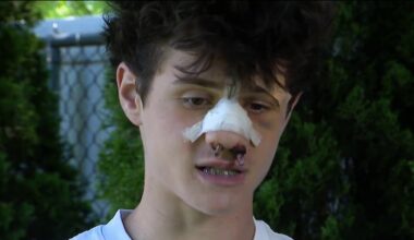 Melville house party teen beating lands 2 teens in hospital – NBC New York