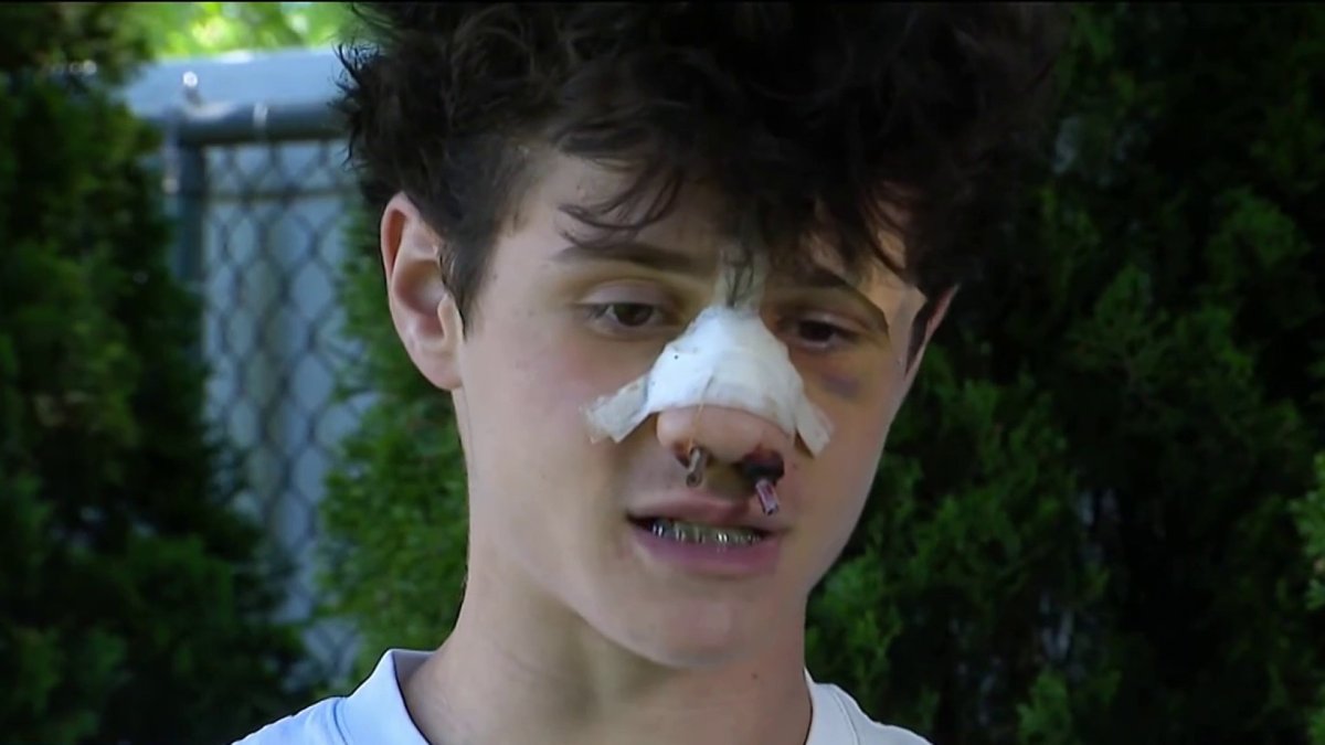 Melville house party teen beating lands 2 teens in hospital – NBC New York