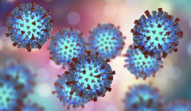 1 confirmed case of measles in Manhattan; person visited restaurant in Hell's Kitchen