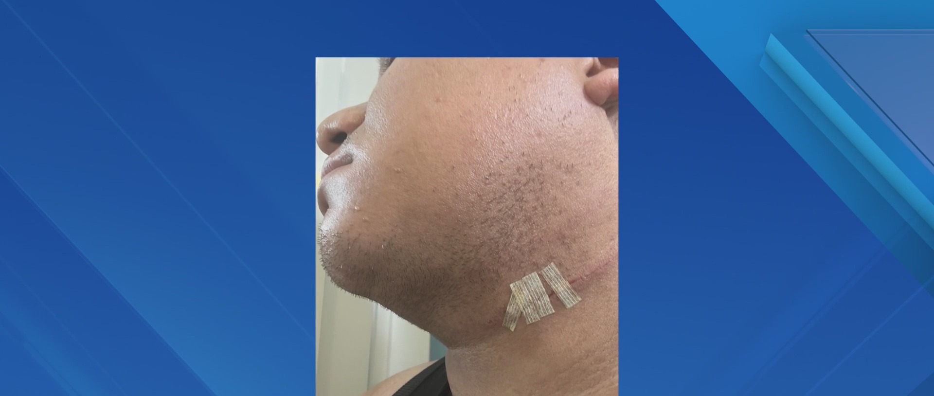 Man slashed in Manhattan subway station: NYPD – PIX11