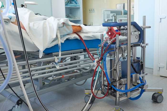 ecmo machine 
