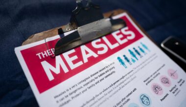 Health officials issue warning after 2nd case of measles on Long Island -- with possible restaurant exposure
