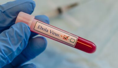 NYC airport to begin enhanced Ebola screenings: What to know