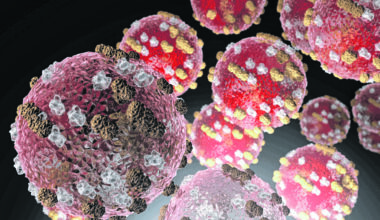 NYC resident with measles dined at Roslyn Heights eatery after Nassau health officials announced first case few days prior