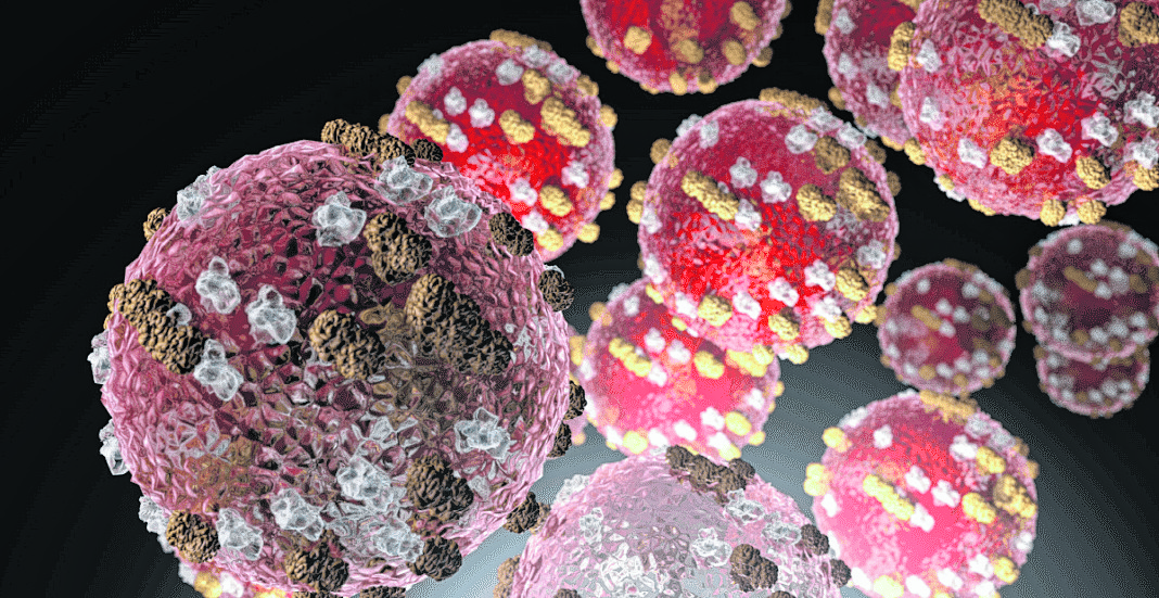 NYC resident with measles dined at Roslyn Heights eatery after Nassau health officials announced first case few days prior