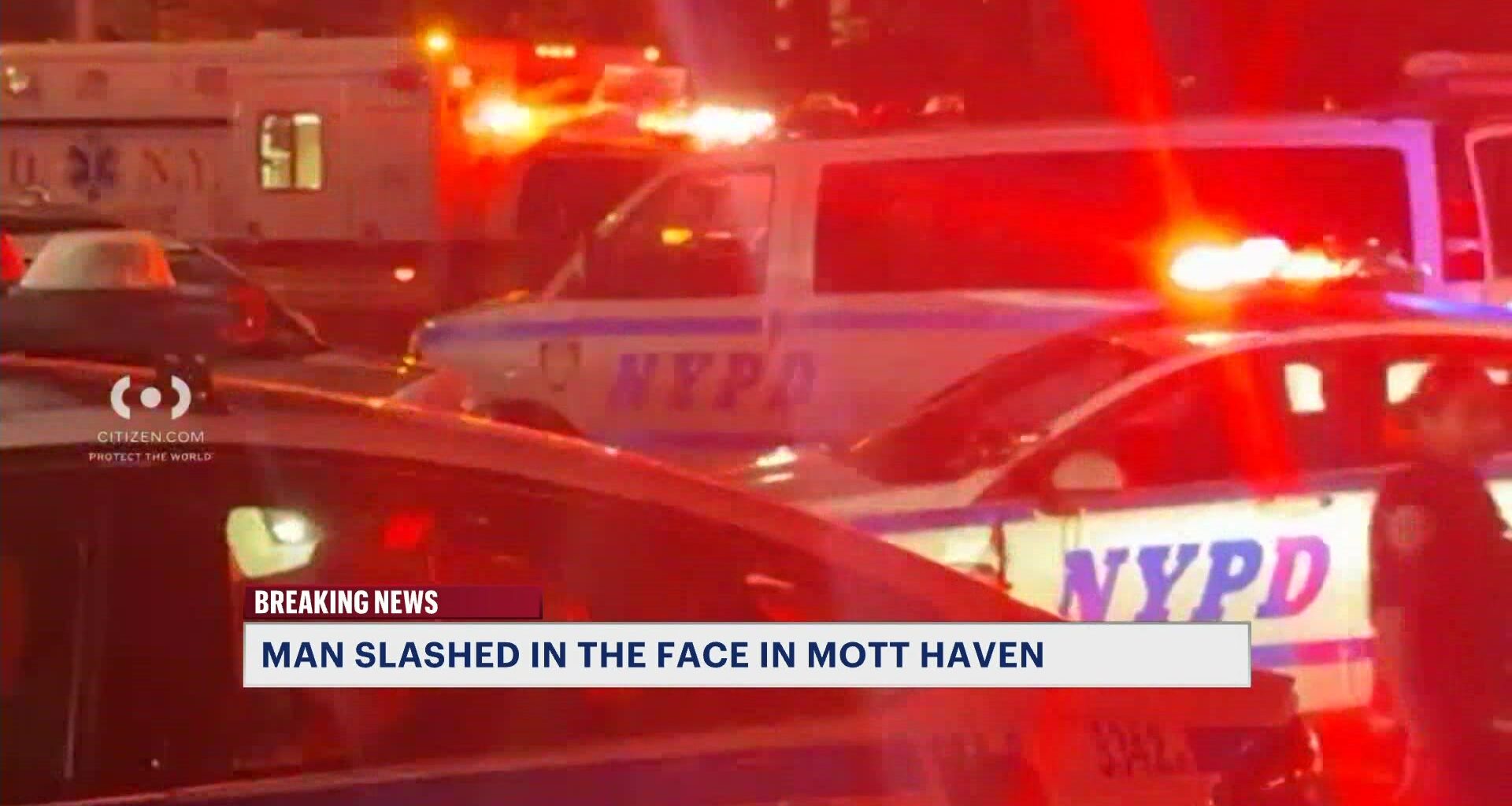 News 12 | Bronx | Man Slashed In The Face Outside Mott Haven Restaurant
