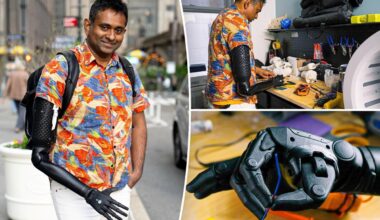 Bronx physicist is first to receive 3D-printed robo-arm