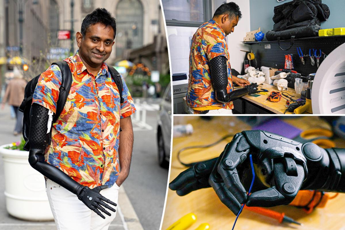 Bronx physicist is first to receive 3D-printed robo-arm