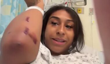 Woman injured protecting 4-year-old nephew in hit-and-run with motorcycle in Mount Vernon