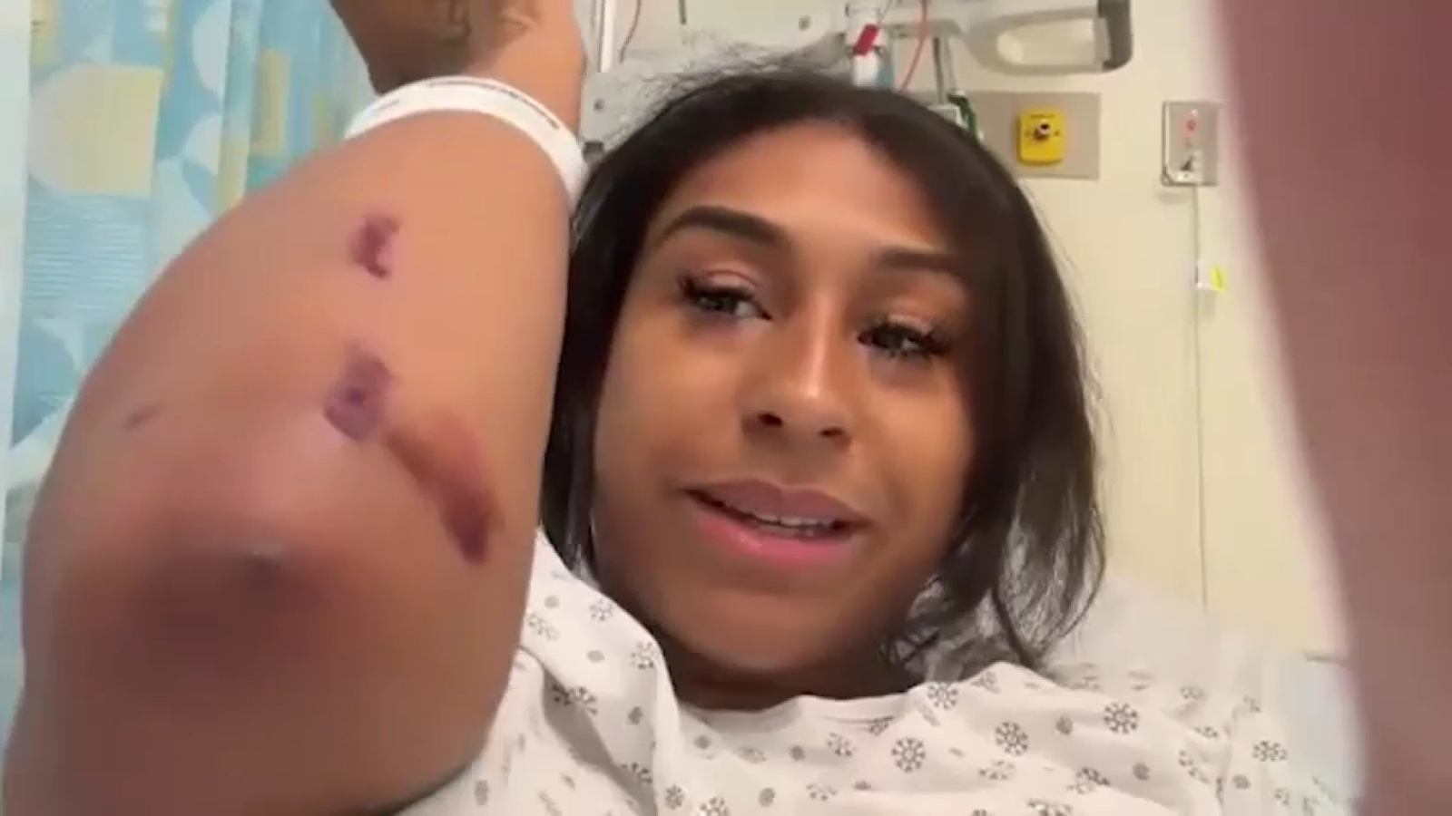 Woman injured protecting 4-year-old nephew in hit-and-run with motorcycle in Mount Vernon