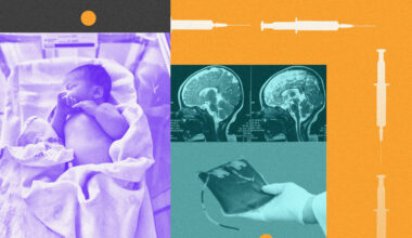 Hospitals See Diseases Resurge as Vaccinations Decline
