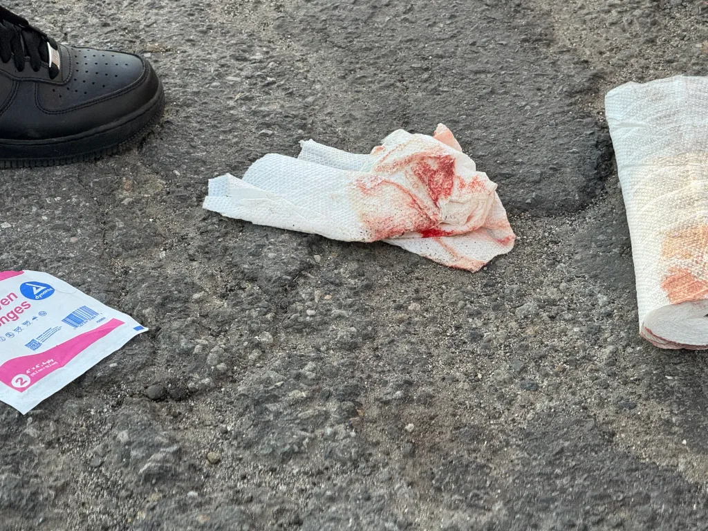 Bloody paper towels and a package of gauze next to a black shoe on asphalt, likely after a bull riding accident.