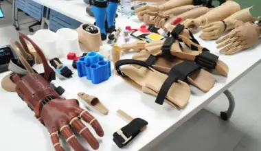 Queen's University Engineers Open-Source Above-Elbow Prosthetic